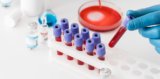 Lyme Antibody (IgM) Biomarker Test Guide