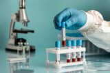 AST Blood Test Explained