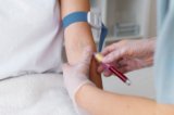 Albumin Blood Test Explained