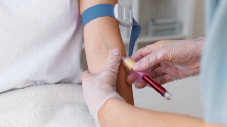 Albumin Blood Test Explained