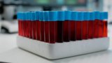 Monocytes Biomarker Test Guide